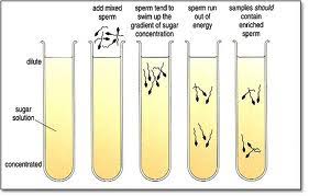 Sperm Preparation