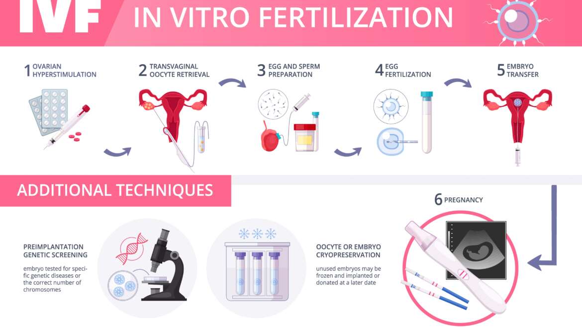 IVF Treatment