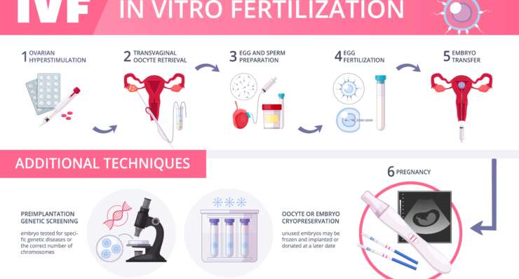 IVF Treatment